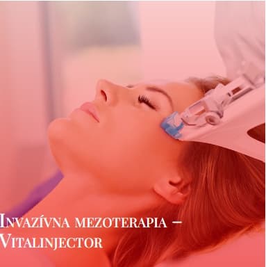 Mezoterapia 1 v Beauty Rescue Žilina