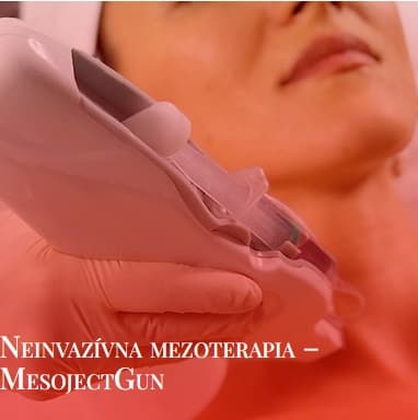 Mezoterapia 2 v Beauty Rescue Žilina